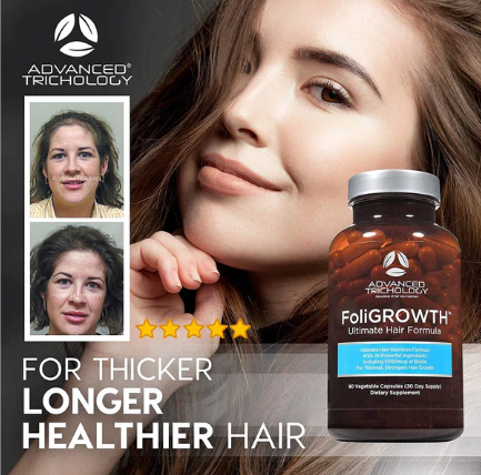 FoliGROWTH Ultimate Hair Nutraceutical